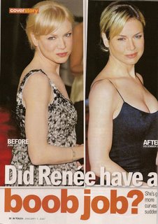 Zellweger boob renee Did Renée