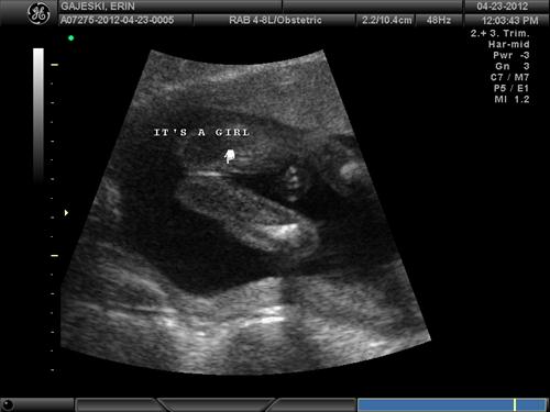 Ultrasound Sex Determination 111