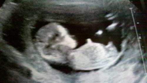 External Image