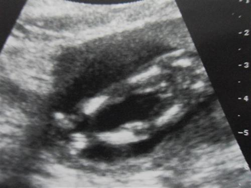 External Image