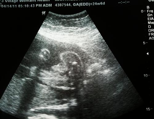 External Image