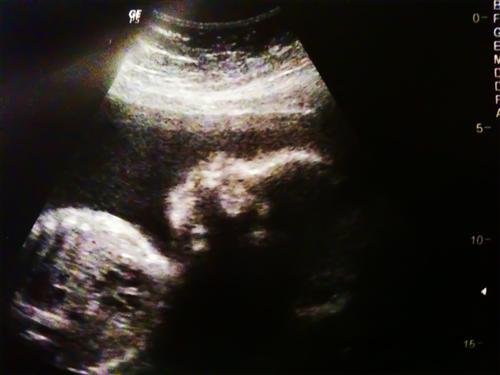 External Image