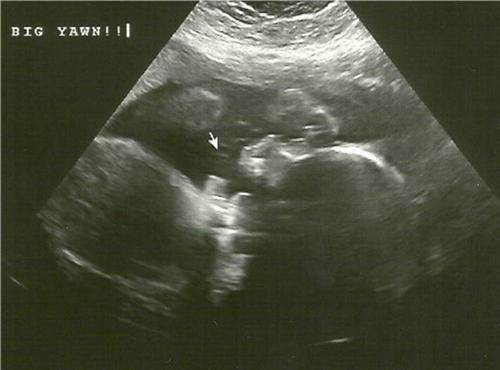 External Image