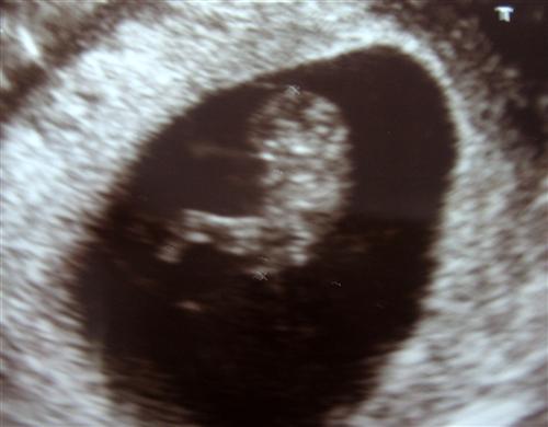 External Image