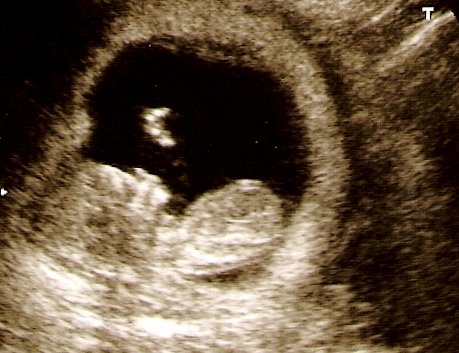 External Image