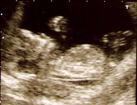 External Image