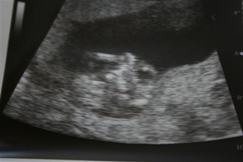 External Image