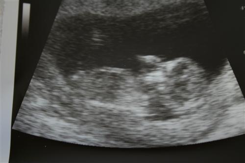 External Image