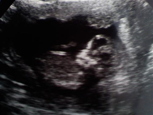 External Image
