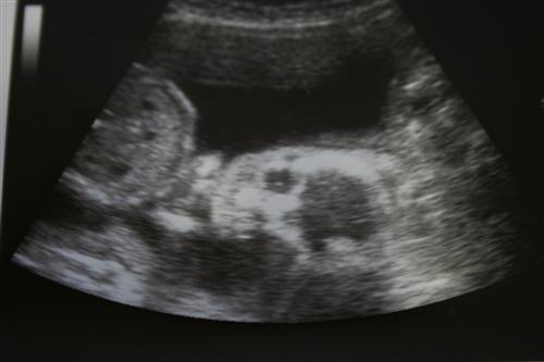 External Image