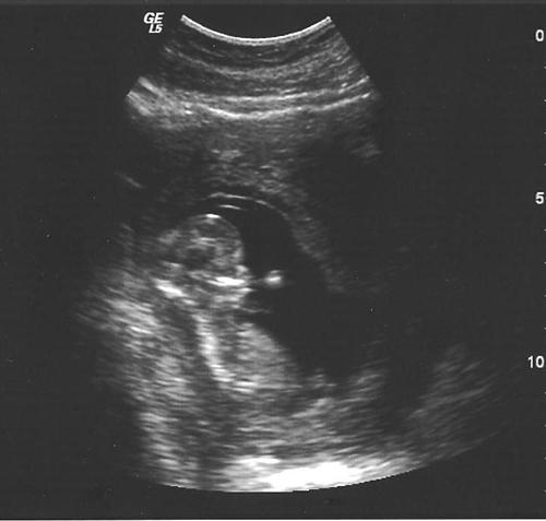 External Image