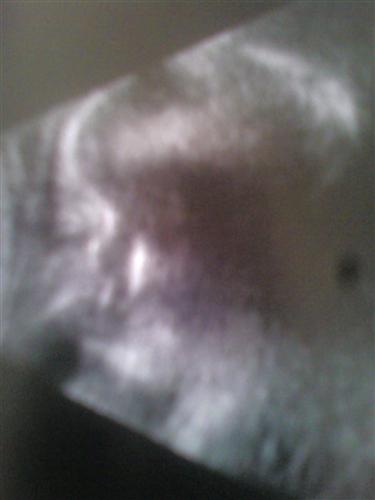 External Image