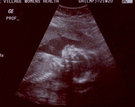 External Image