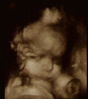 External Image