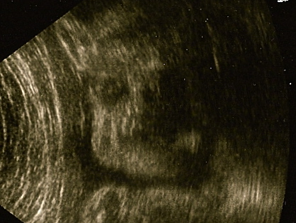 External Image