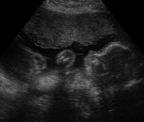 External Image