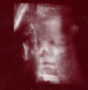 External Image